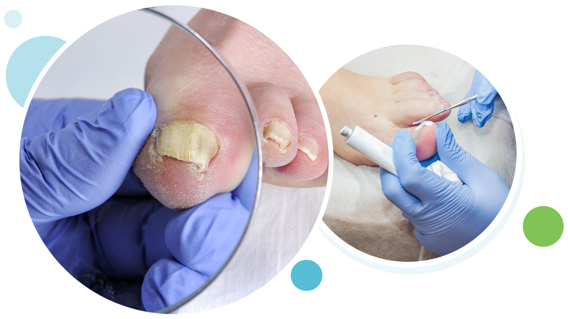 Naturasil Review – Is It One Of The Best Or Another Scam?