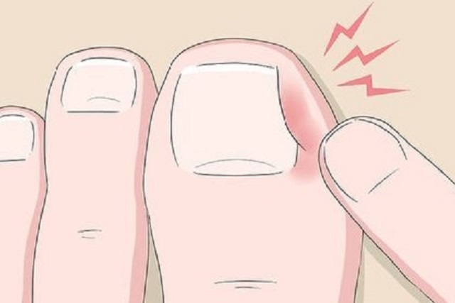 common nail problems and remedies 640x427